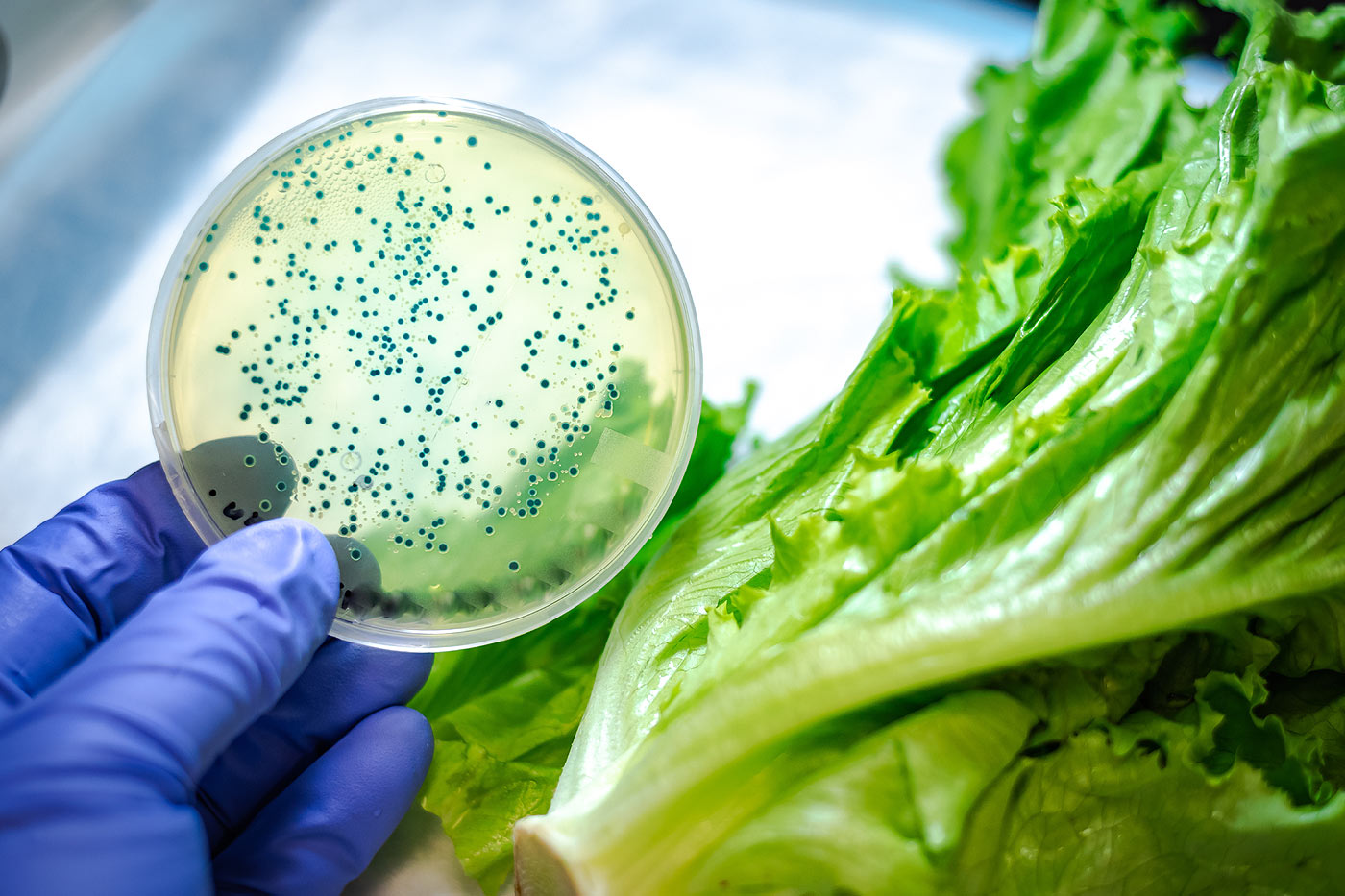 E. coli : un acteur majeur des infections urinaires